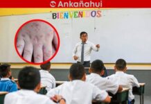 Confirman casos de virus Coxsackie en colegios de Piura ugel-piura-casos-virus-coxsackie-colegios.jpg